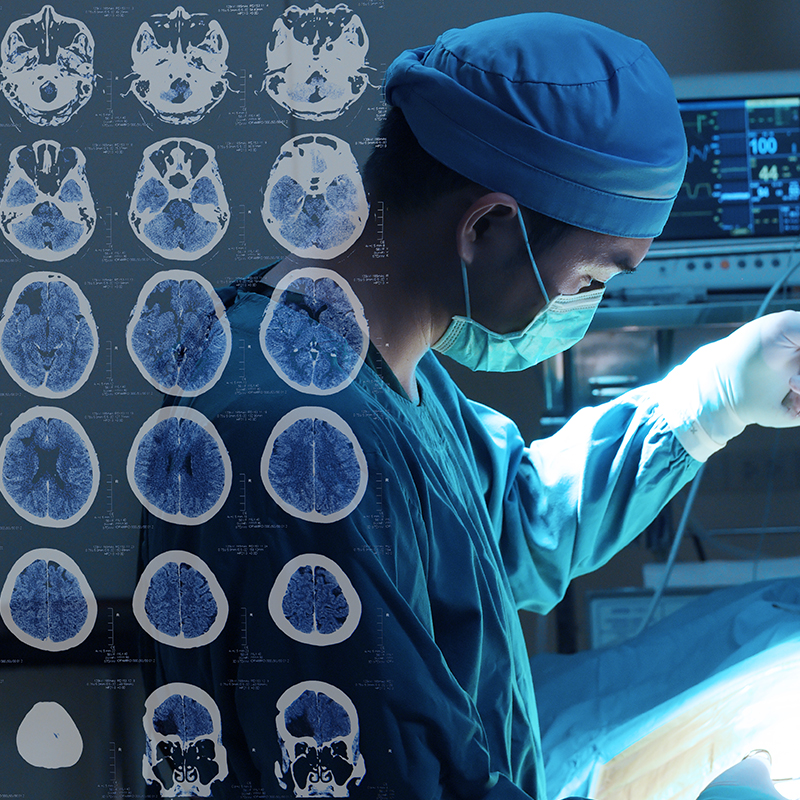 腦膜瘤用開顱嗎？