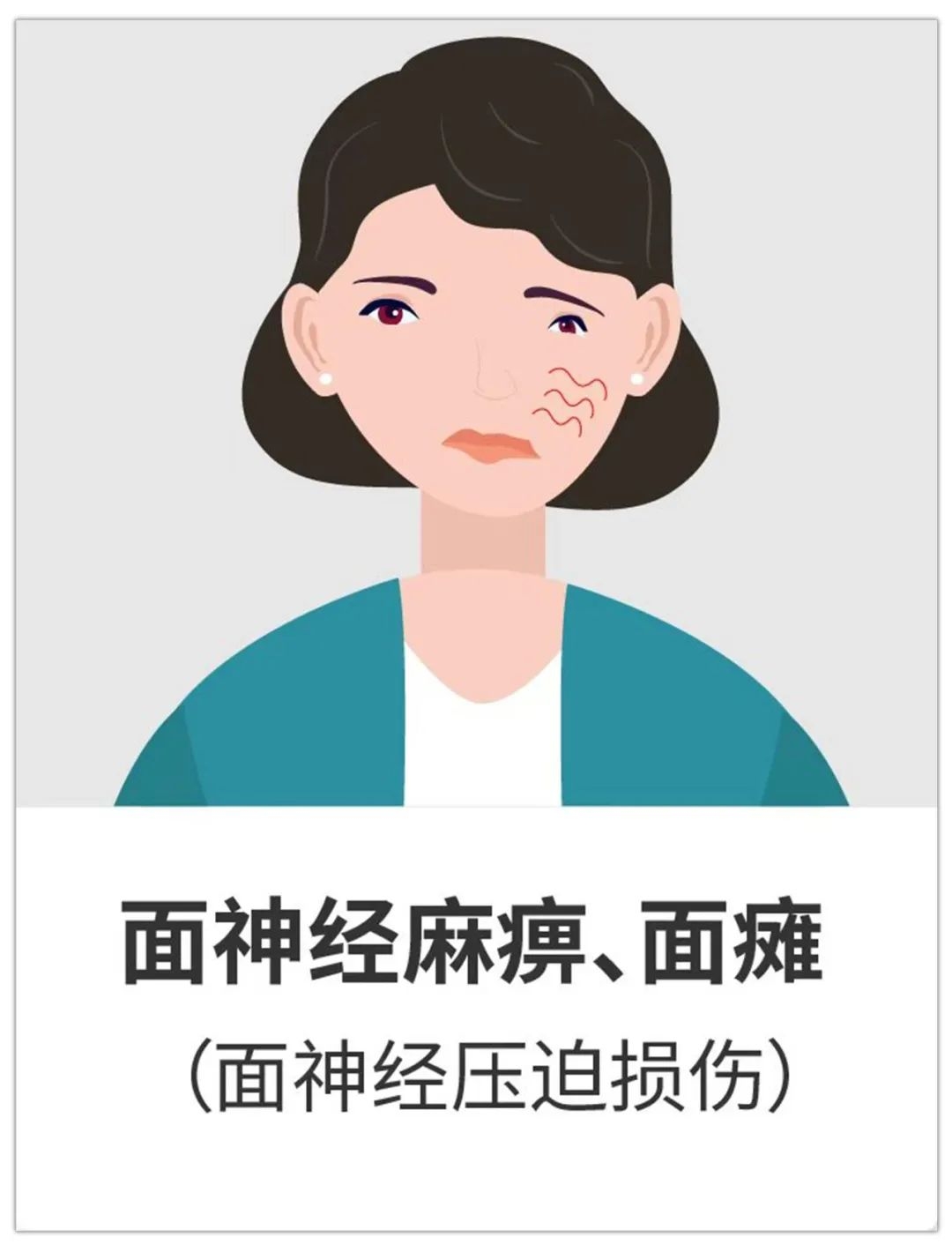 聽神經(jīng)瘤手術(shù)后會面癱的幾率大嗎？