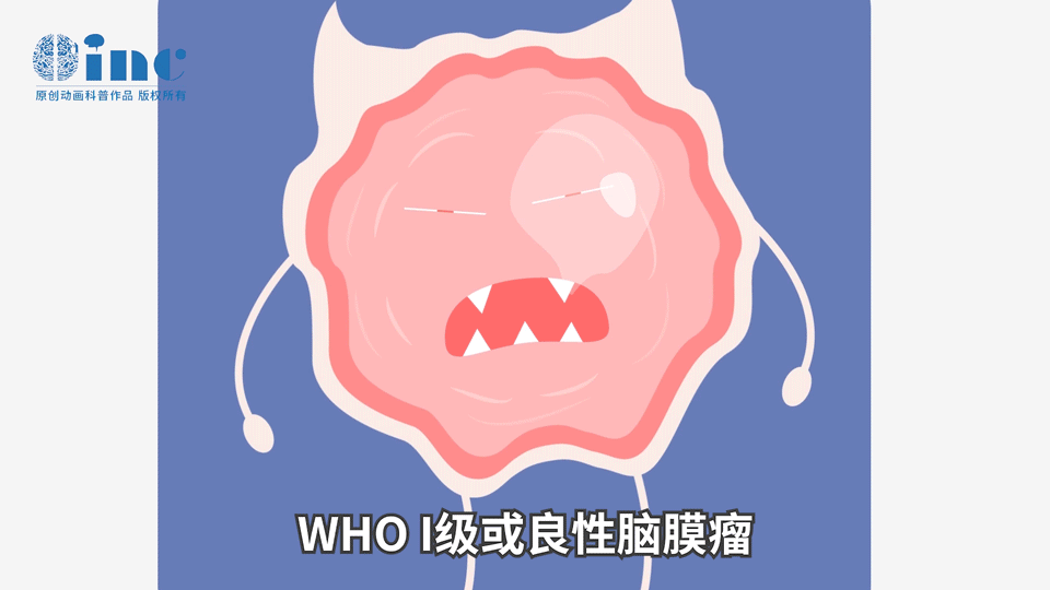 腦膜瘤的較佳治療方法-1