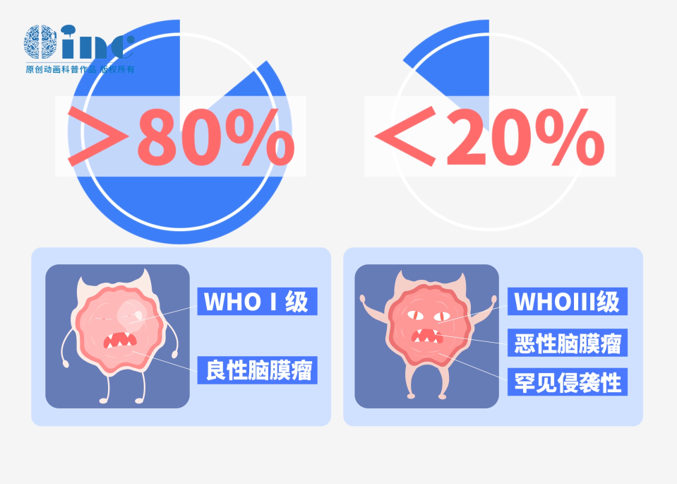 良性腦膜瘤能活多久