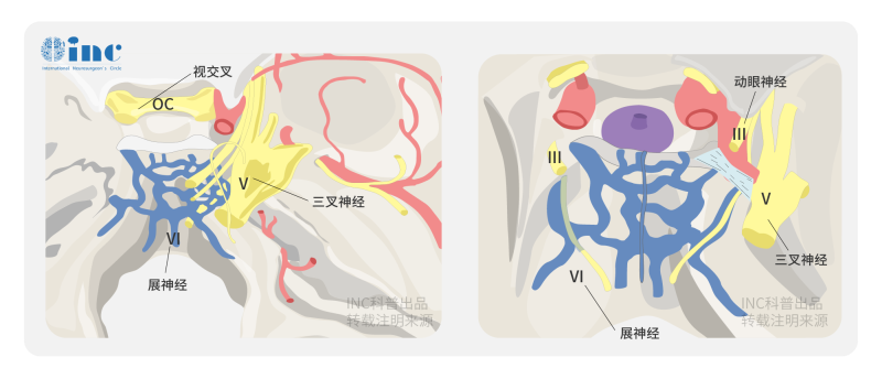視神經(jīng)膠質(zhì)瘤治療較好的是什么辦法？預(yù)后怎么樣？