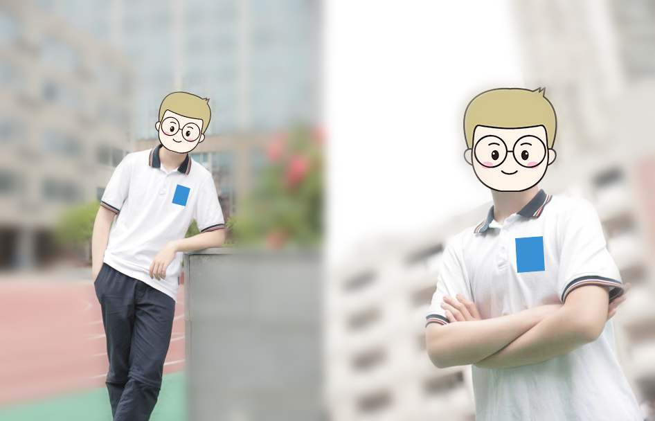 腦干膠質(zhì)瘤可以治愈嗎？腦干膠質(zhì)瘤伴嚴(yán)重腦室擴(kuò)張積水，德國(guó)術(shù)后1年半考入名校、體育滿分