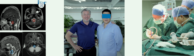 INC成功手術(shù)案例之腦干海綿狀血管瘤僅?！?月生命”，如何順利全切？