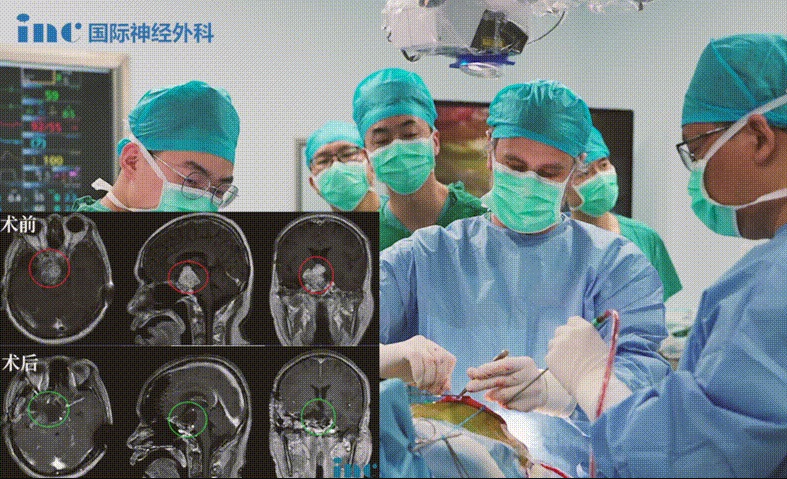 聆聽(tīng)這對(duì)夫妻講述抗擊脊