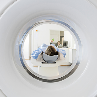 視神經(jīng)膠質(zhì)瘤如何治療