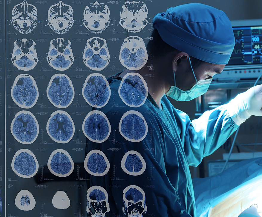 膠質(zhì)瘤是什么病？膠質(zhì)瘤檢查