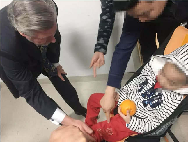 腦膠質(zhì)瘤患者圖片——寶寶膠質(zhì)瘤能治愈嗎