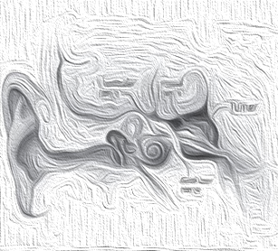 【聽神經瘤】聽神經鞘瘤切除是不是大手術？