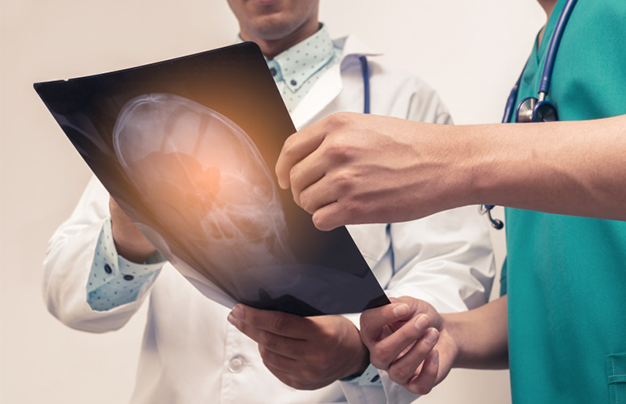 質(zhì)子治療<a href='/qianyan/naozhongliu/' target='_blank'><u>腦腫瘤</u></a>