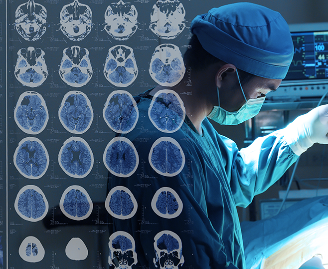 左枕葉膠質(zhì)瘤嚴(yán)重嗎？