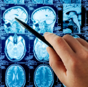 為什么膠質(zhì)母細(xì)胞瘤在手術(shù)后經(jīng)常重新生長(zhǎng)？