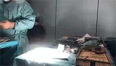 顱咽管瘤手術(shù)——腦瘤切不干凈怎么辦