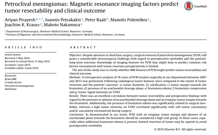 巖斜區(qū)腦膜瘤