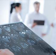 神外快訊：兒童低級別腦部膠質(zhì)瘤治療方法有何進展？