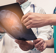 松果體細(xì)胞瘤的治療：手術(shù)和放療后如何控制腫瘤生長