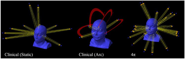 聽神經(jīng)瘤放療