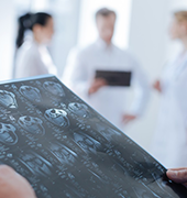 膠質(zhì)母細(xì)胞瘤復(fù)發(fā)的治療方案與應(yīng)對