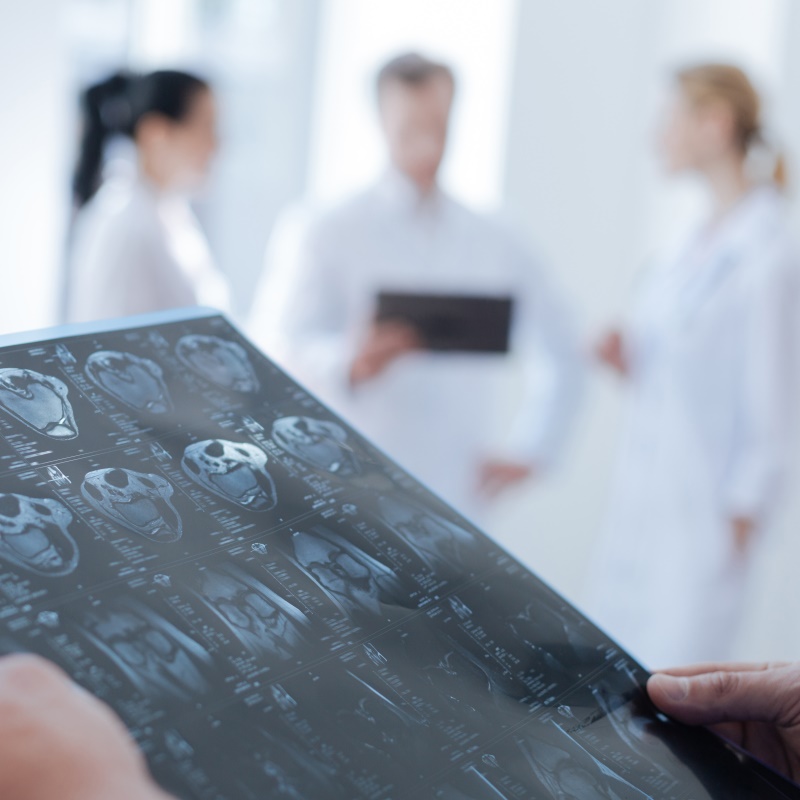 膠質(zhì)母細(xì)胞瘤免疫治療臨床試驗(yàn)的優(yōu)先方案