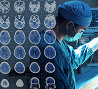 腦膠質(zhì)瘤較長壽命、顱內(nèi)膠質(zhì)瘤3~4級能活多久？