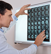 腦膜瘤復(fù)發(fā)什么癥狀？可以評(píng)估嗎？