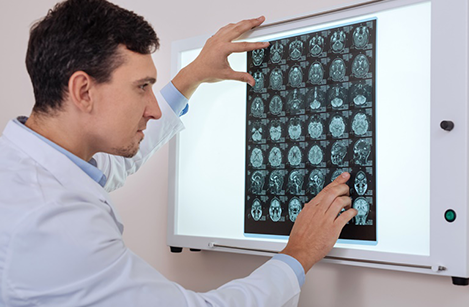 如何選擇腦干海綿狀血管瘤的治療方案