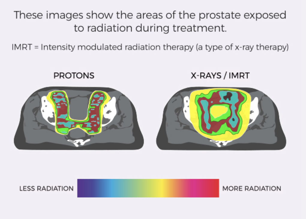 膠質(zhì)瘤術(shù)后需要放療嗎？較好時機(jī)是什么？