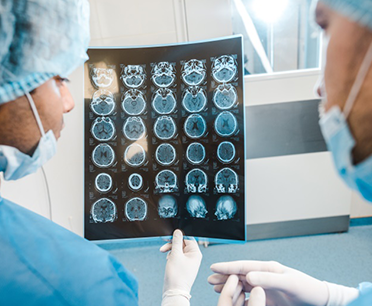 額葉膠質瘤之額葉切除術操作技巧