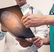 多發(fā)性膠質(zhì)瘤能治好嗎？