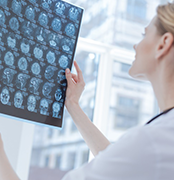 膠質(zhì)瘤手術(shù)是微創(chuàng)手術(shù)嗎？膠質(zhì)瘤手術(shù)方式選擇