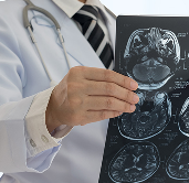 「腦膜瘤嚴(yán)重嗎」老年人腦膜瘤嚴(yán)重嗎？