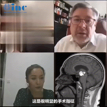 腦干海綿狀血管瘤咨詢