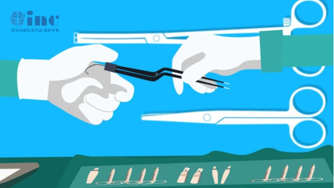 丘腦膠質(zhì)瘤手術(shù)后遺癥,丘腦膠質(zhì)瘤術(shù)后并發(fā)癥