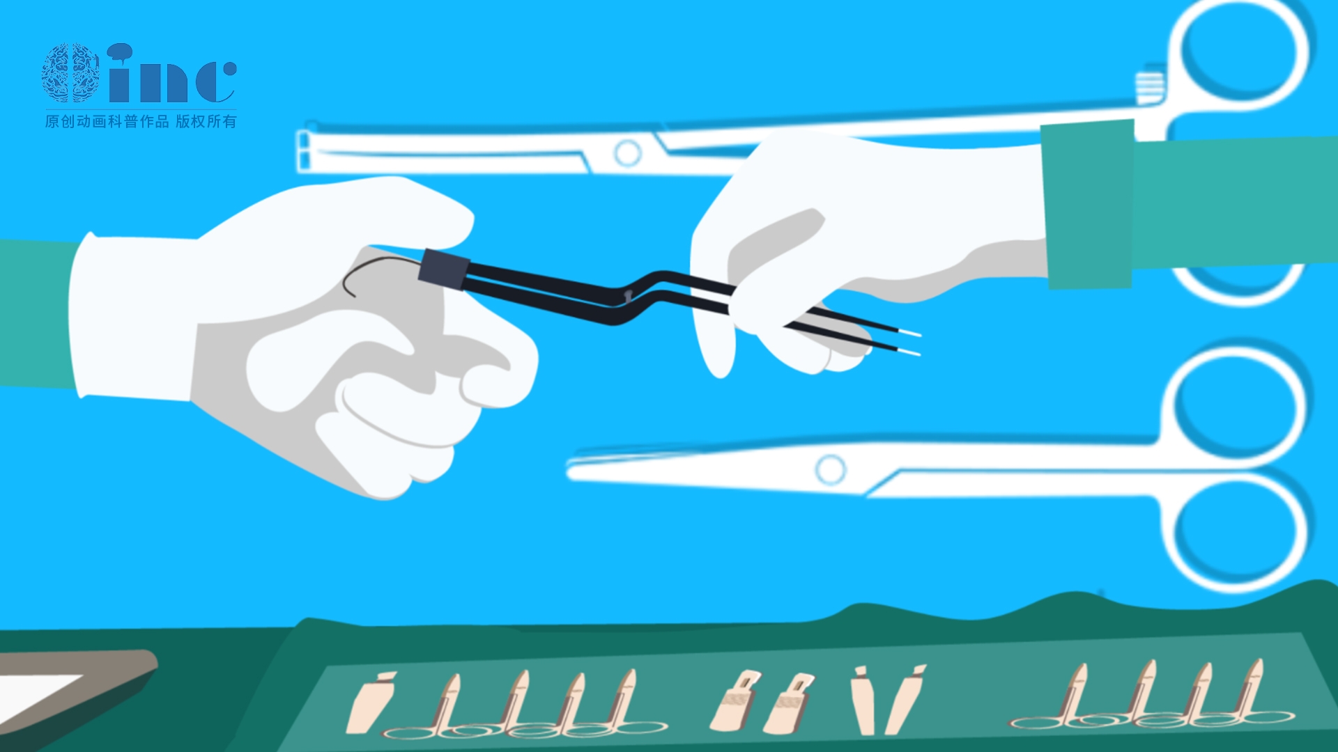 國外膠質(zhì)瘤手術(shù)專家哪些比較好？膠質(zhì)瘤國外治療專家