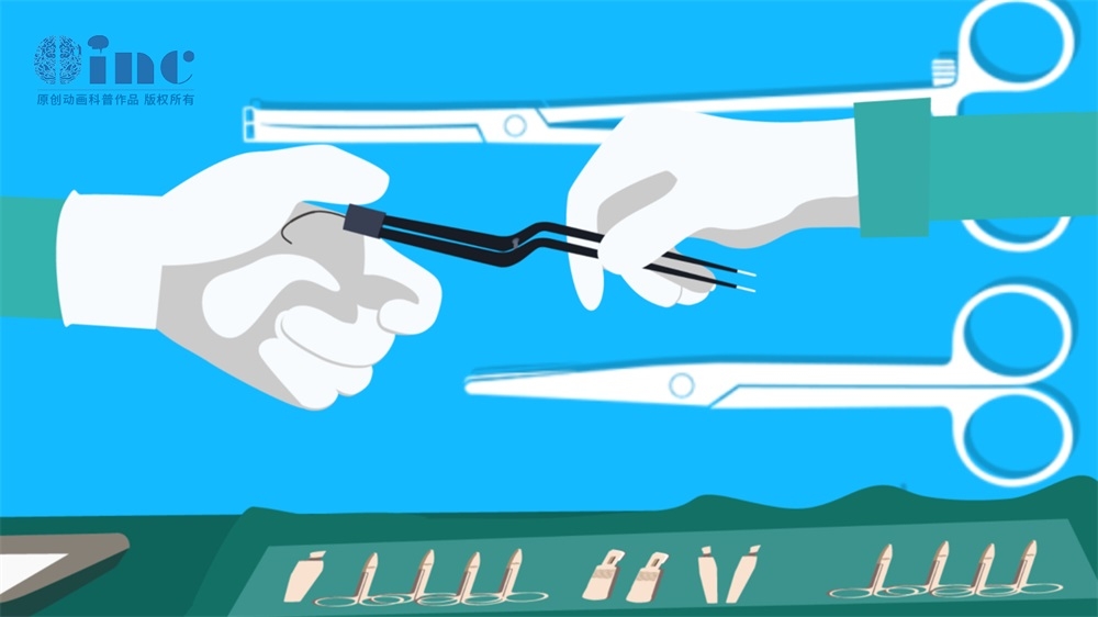 海綿狀血管瘤怎么治療比較好？頭部海綿狀血管瘤怎么治療？