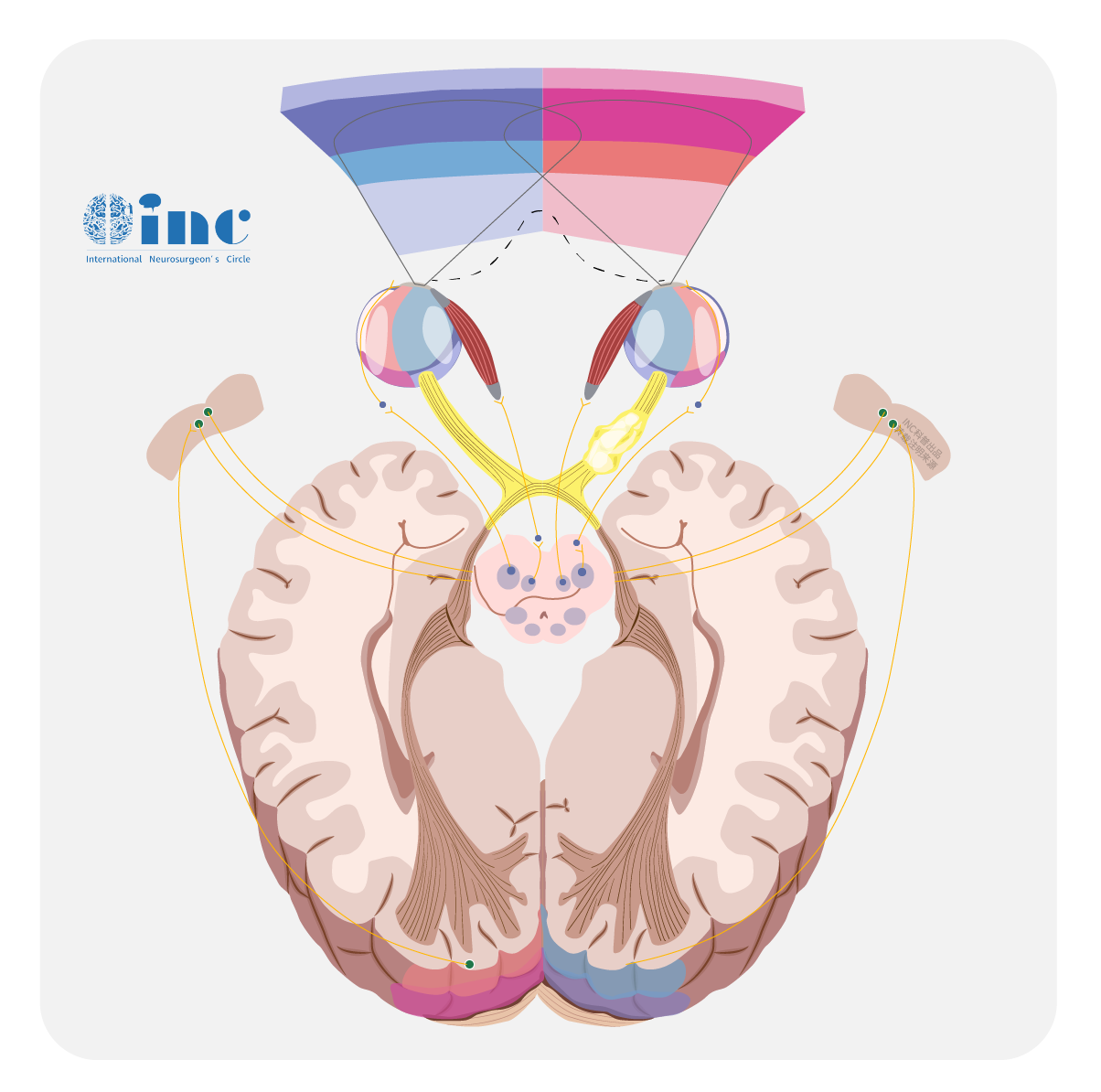 視神經(jīng)腦膜瘤手術(shù)治療還是放療治療好？