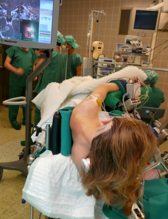 腦干海綿狀血管瘤手術(shù)