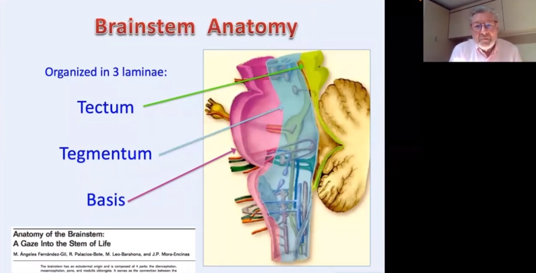 腦干海綿狀血管瘤手術(shù)成功率高嗎？INC巴教授312例成功案例解析