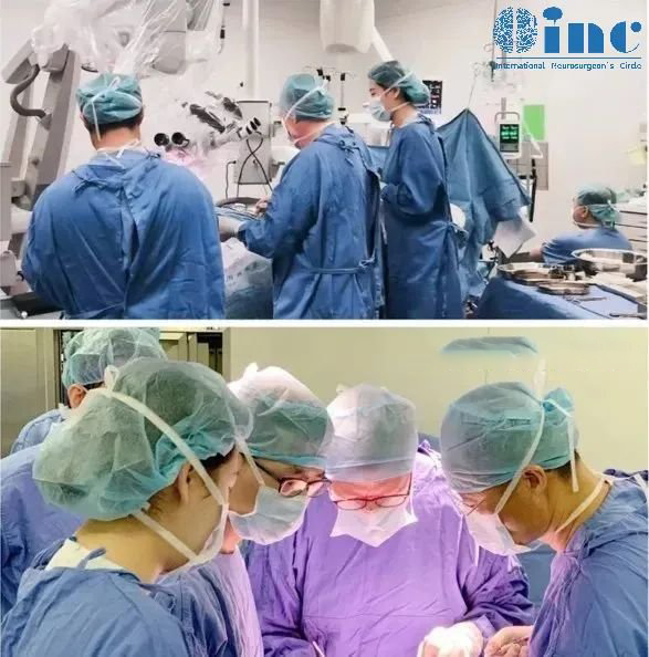 腦干術(shù)后4年沒有復(fù)發(fā)、還喜添一子，巴教授中腦頂蓋膠質(zhì)瘤示范手術(shù)長期隨訪