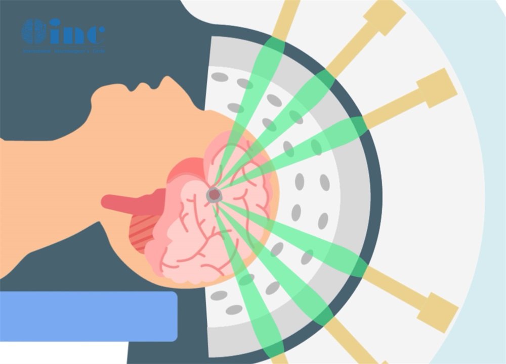 <a href='/bingzhong/xueguanliu/' target='_blank'><u>腦海綿狀血管瘤</u></a>