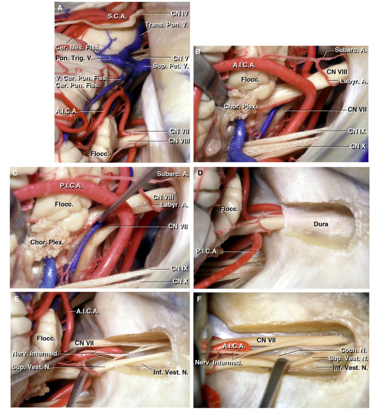 顯微神經(jīng)外科解剖學(xué)