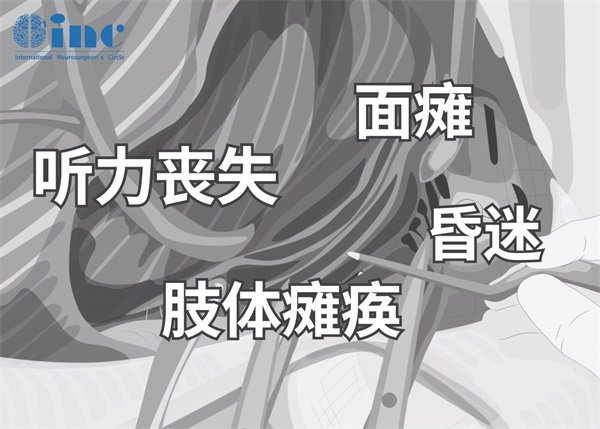 聽神經(jīng)瘤手術(shù)需要幾個(gè)小時(shí)