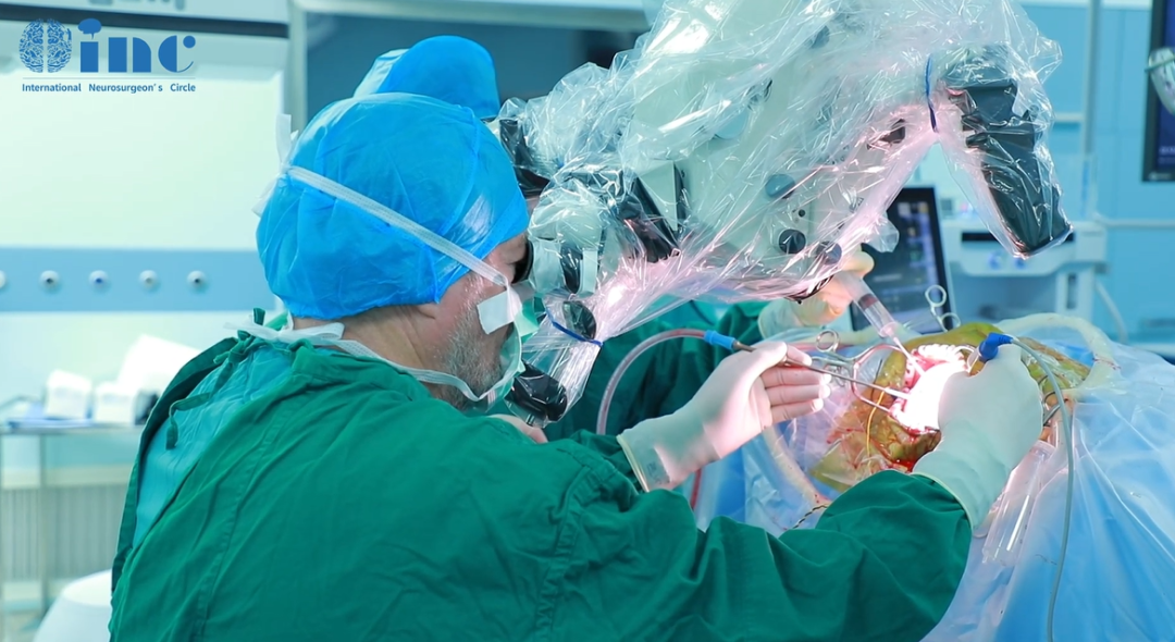 膠質(zhì)瘤致精英女性突發(fā)癲癇、失去意識，腦瘤全切術(shù)后重回職場！