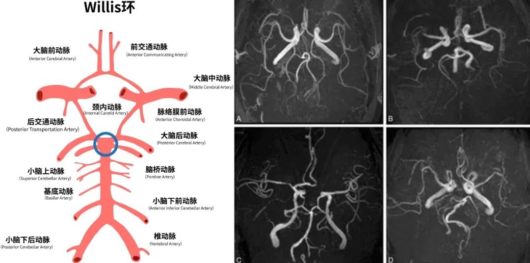 顱咽管瘤的手術(shù)成功率高不高？風(fēng)險(xiǎn)大嗎？