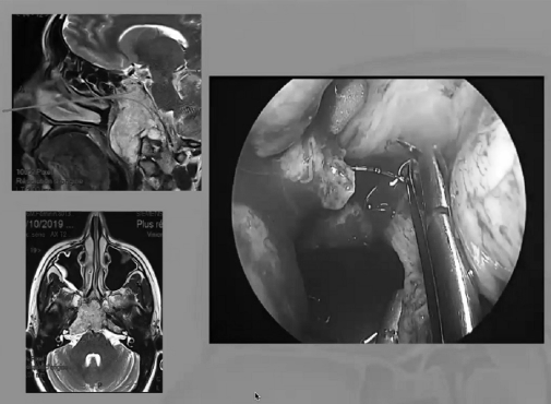 內(nèi)鏡手術(shù)圖片1