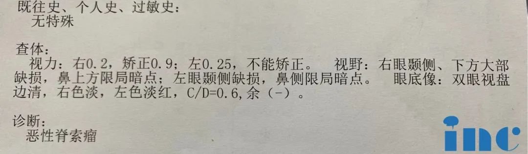 開顱手術(shù)圖片