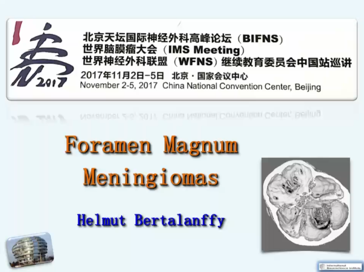 巴教授天壇演講回顧之枕骨大孔區(qū)腦膜瘤圖片