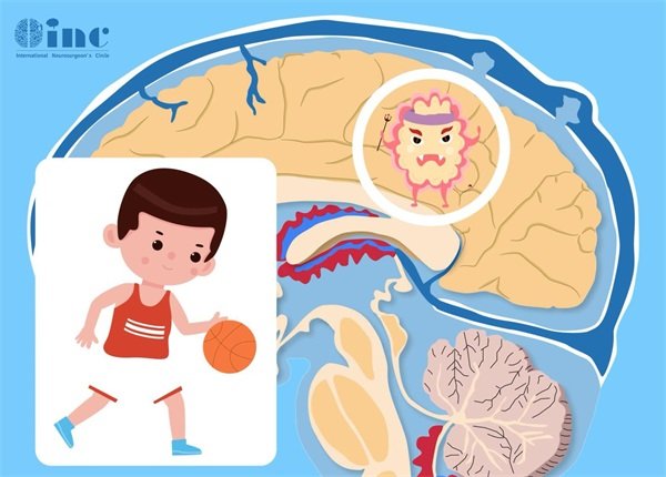 聽神經(jīng)瘤2公分嚴(yán)重嗎?手術(shù)好切嗎?