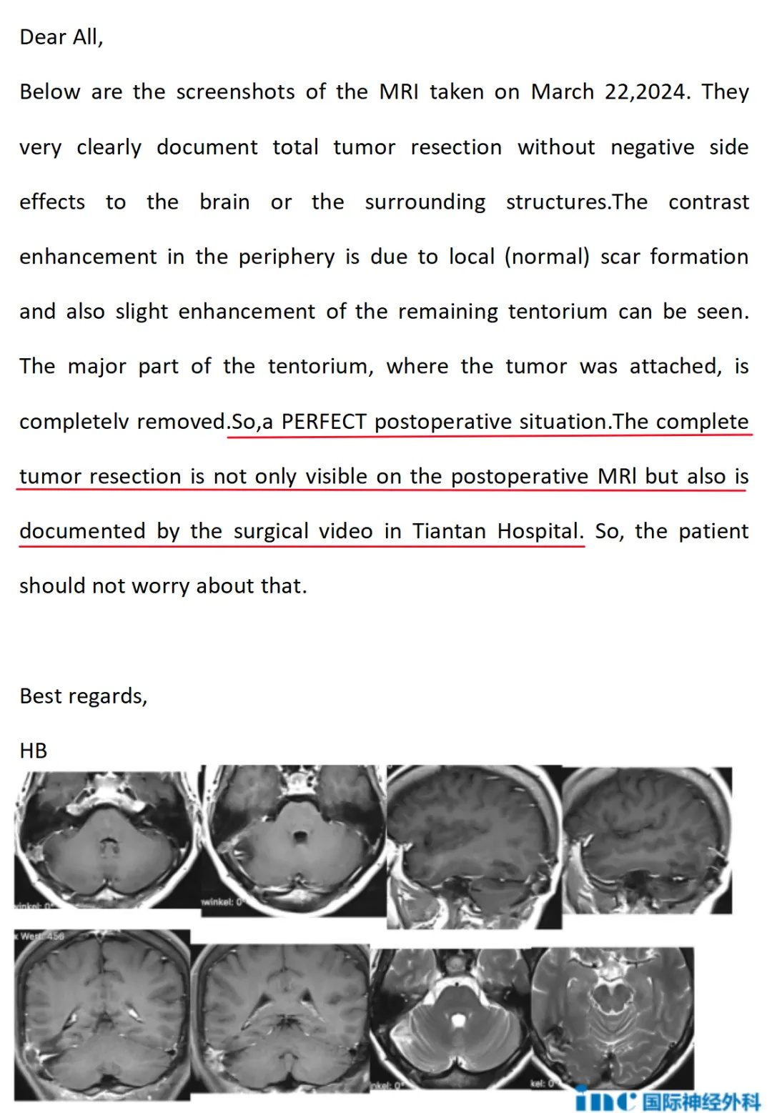 術(shù)后半年隨訪時(shí)，巴教授在查看了孫女士影像后回復(fù)