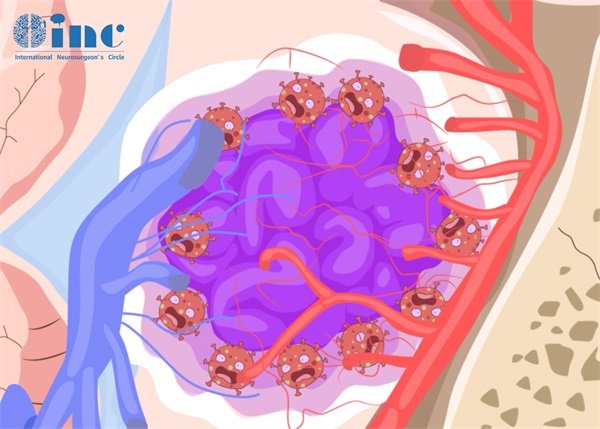 下丘腦海綿狀血管瘤術(shù)后