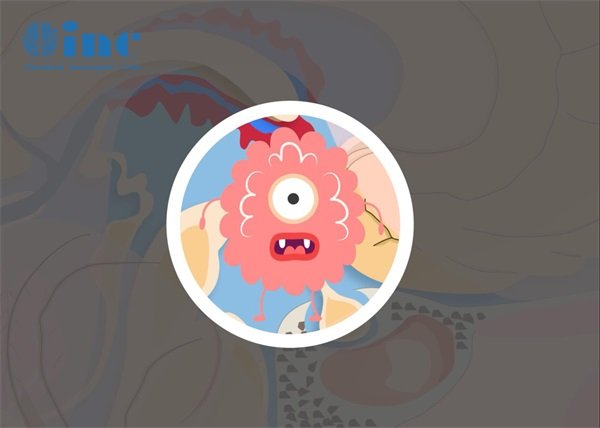 兒童2歲半脊索瘤怎么辦?